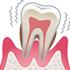 歯周病治療